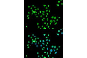 Immunofluorescence analysis of U2OS cells using macroH2A. (H2AFY Antikörper  (AA 123-372))