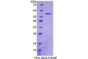 SDS-PAGE analysis of Mouse LDHB Protein. (LDHB Protein)