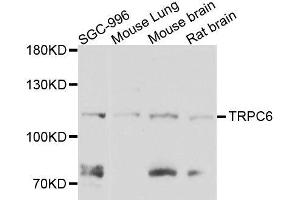 Western blot analysis of extracts of various cell lines, using TRPC6 antibody. (TRPC6 Antikörper  (AA 500-600))