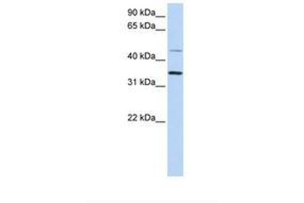 CLN6 Antikörper  (C-Term)