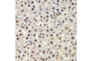 Immunohistochemistry of paraffin-embedded rat liver using TOR1A antibody. (TOR1A Antikörper)