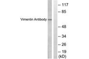 Western Blotting (WB) image for anti-Vimentin (VIM) (AA 411-460) antibody (ABIN2889287) (Vimentin Antikörper  (AA 411-460))