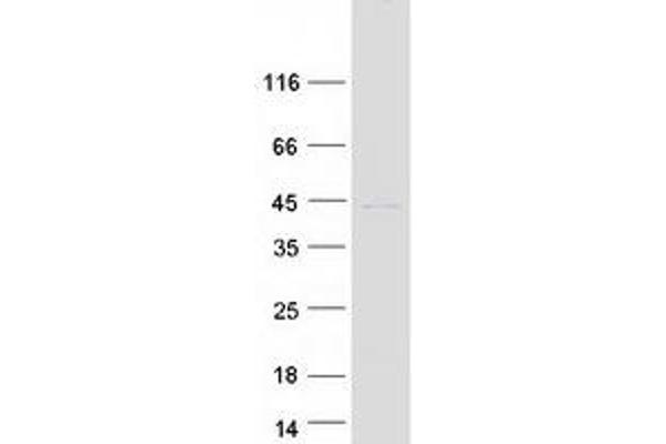 TNNT3 Protein (Transcript Variant 1) (Myc-DYKDDDDK Tag)