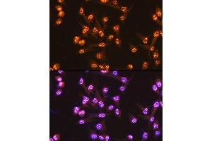 Immunofluorescence analysis of U-2 OS cells using PUMA Rabbit mAb (ABIN1678790, ABIN3018050, ABIN3018051 and ABIN7101572) at dilution of 1:100 (40x lens). (PUMA Antikörper)