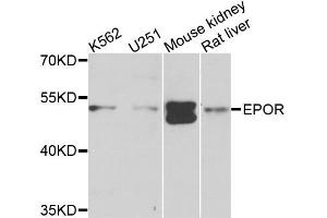 Western blot analysis of extracts of various cell lines, using EPOR antibody. (EPOR Antikörper)