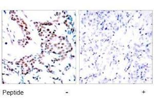 Image no. 1 for anti-Jun Proto-Oncogene (JUN) (Tyr170) antibody (ABIN197133) (C-JUN Antikörper  (Tyr170))