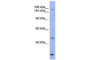 WB Suggested Anti-ATP7A Antibody Titration:  0. (ATP7A Antikörper  (Middle Region))