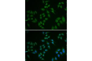 Immunofluorescence analysis of U2OS cells using TP63 antibody. (TCP1 alpha/CCTA Antikörper)