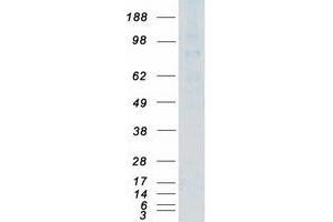 Validation with Western Blot (DLL1 Protein (Myc-DYKDDDDK Tag))