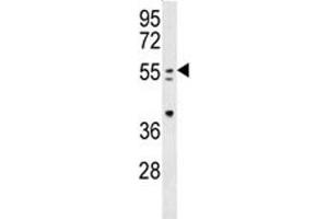 PAX-7 antibody western blot analysis in mouse spleen tissue lysate (PAX7 Antikörper  (AA 410-437))