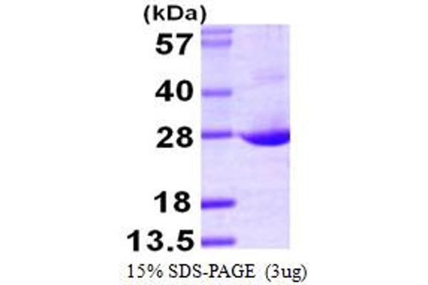 AES Protein (AA 1-197) (His tag)