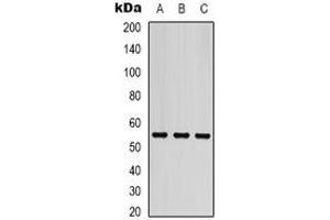 Western blot analysis of Beta-tubulin expression in Hela (A), mouse brain (B), rat brain (C) whole cell lysates. (TUBB Antikörper)