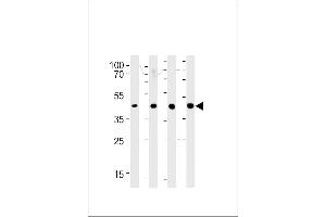 Western blot analysis in 293,LNCaP,PC-3,NCI-H292 cell line lysates (35ug/lane). (SRD5A3 Antikörper  (C-Term))