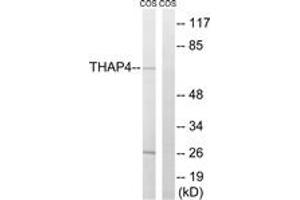 Western blot analysis of extracts from COS7 cells, using THAP4 Antibody. (THAP4 Antikörper  (AA 341-390))