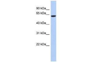 CAMKV antibody used at 1 ug/ml to detect target protein. (CAMKV Antikörper  (N-Term))