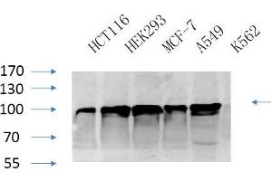 Western Blotting (WB) image for anti-Calnexin (CANX) (Ser583) antibody (ABIN5956269) (Calnexin Antikörper  (Ser583))