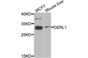 Western blot analysis of extracts of various cell lines, using DERL1 antibody (ABIN5974694) at 1/1000 dilution. (DERL1 Antikörper)