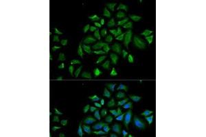 Immunofluorescence analysis of HeLa cells using FGFR1 Polyclonal Antibody (FGFR1 Antikörper)