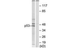 Western blot analysis of extracts from 293 cells, using p53 (Ab-378) Antibody. (p53 Antikörper  (AA 336-385))