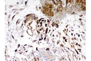 IHC analysis of IGFBP1 using anti- IGFBP1 antibody . (IGFBPI Antikörper  (AA 69-259))