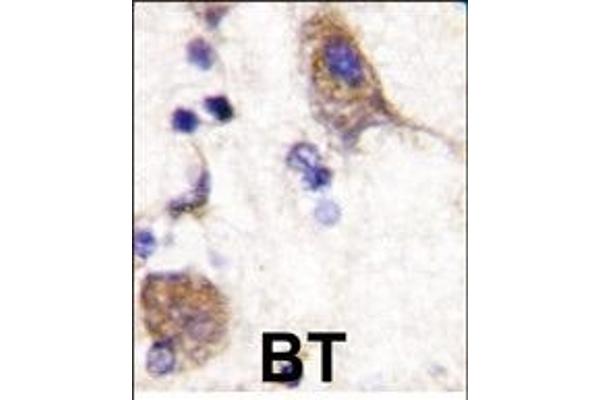 SCYL2 Antikörper  (C-Term)