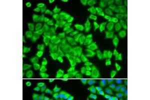 Immunofluorescence analysis of HeLa cells using STIP1 Polyclonal Antibody (STIP1 Antikörper)
