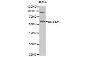 Western Blotting (WB) image for anti-UDP Glucuronosyltransferase 1 Family, Polypeptide A1 (UGT1A1) antibody (ABIN1875274) (UGT1A1 Antikörper)