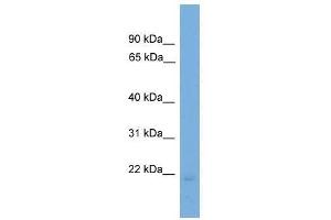 Western Blot showing EDN2 antibody used at a concentration of 1-2 ug/ml to detect its target protein. (Endothelin 2 Antikörper  (N-Term))