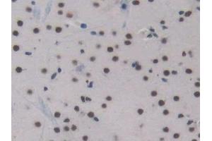 Detection of ENG in Mouse Cerebrum Tissue using Polyclonal Antibody to Endoglin (ENG) (Endoglin Antikörper  (AA 27-137))