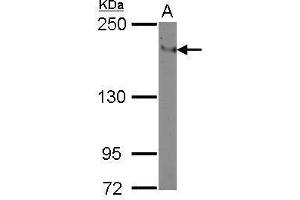 WB Image Sample (30 ug of whole cell lysate) A: THP-1 5% SDS PAGE antibody diluted at 1:500 (ITGAL Antikörper  (Center))