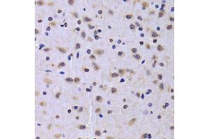 Immunohistochemistry of paraffin-embedded rat brain using NUDC antibody. (NUDC Antikörper  (AA 1-331))