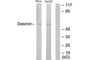 Western Blotting (WB) image for anti-Desmin (DES) (AA 26-75) antibody (ABIN2888927) (Desmin Antikörper  (AA 26-75))