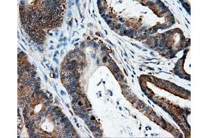 Immunohistochemistry (IHC) image for anti-Intraflagellar Transport 57 Homolog (IFT57) antibody (ABIN1498809) (IFT57 Antikörper)