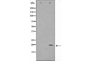 Western blot analysis on HepG2 cell lysate using KAD6 Antibody，The lane on the left is treated with the antigen-specific peptide. (TAF9 Antikörper  (Internal Region))