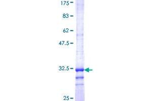 Image no. 1 for Histone Cluster 1, H3e (HIST1H3E) (AA 69-125) protein (GST tag) (ABIN1306688) (HIST1H3E Protein (AA 69-125) (GST tag))