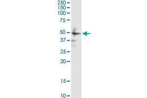 ZIC1 monoclonal antibody (M06), clone 4D2. (ZIC1 Antikörper  (AA 139-212))