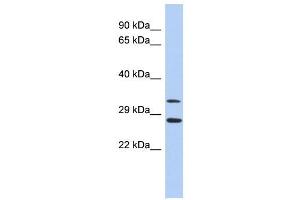 Western Blot showing BIRC7 antibody used at a concentration of 1-2 ug/ml to detect its target protein. (BIRC7 Antikörper  (Middle Region))