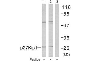 Image no. 2 for anti-Cyclin-Dependent Kinase Inhibitor 1B (p27, Kip1) (CDKN1B) (Ser10) antibody (ABIN197350) (CDKN1B Antikörper  (Ser10))