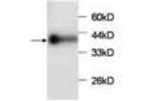 Image no. 1 for anti-Chemokine (C-C Motif) Ligand 2 (CCL2) antibody (ABIN791500) (CCL2 Antikörper)
