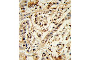 Immunohistochemistry (Paraffin-embedded Sections) (IHC (p)) image for anti-BMI1 Polycomb Ring Finger Oncogene (BMI1) antibody (ABIN652702)