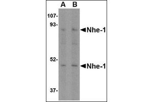 Western blot analysis of Nhe-1 in rat kidney tissue lysate with in with this product at (A) 1 and (B) 2 μg/ml. (SLC9A1 Antikörper  (C-Term, N-Term))