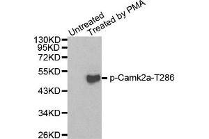 Western Blotting (WB) image for anti-Calcium/calmodulin-Dependent Protein Kinase II alpha (CAMK2A) (pThr286) antibody (ABIN1870029) (CAMK2A Antikörper  (pThr286))
