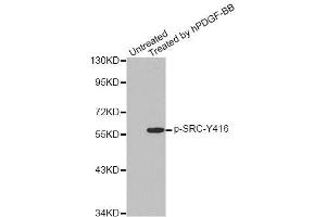 Western blot analysis of extracts from COLO205 cells, using Phospho-SRC-Y418 antibody (ABIN5969963). (Src Antikörper  (pTyr418))