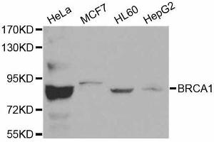 Western blot analysis of extracts of various cell lines, using BRCA1 antibody. (BRCA1 Antikörper  (AA 120-220))