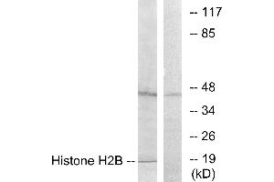 Immunohistochemistry analysis of paraffin-embedded human brain tissue using Histone H2B antibody. (Histone H2B Antikörper)