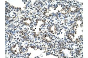 Glycoprotein antibody was used for immunohistochemistry at a concentration of 4-8 ug/ml to stain Alveolar cells (arrows) in Human Lung. (Glycoprotein Antikörper)