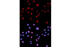 Immunofluorescence analysis of MCF-7 cells using Phospho-CDK1-T161 antibody (ABIN5969957). (CDK1 Antikörper  (pThr161))