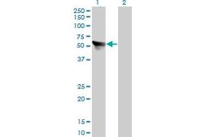 Western Blotting (WB) image for anti-Chaperonin Containing TCP1, Subunit 7 (Eta) (CCT7) (AA 425-528) antibody (ABIN564614)