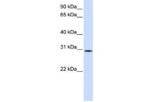 Western Blotting (WB) image for anti-Sushi Domain Containing 6 (SUSD6) antibody (ABIN2459068) (SUSD6/KIAA0247 Antikörper)