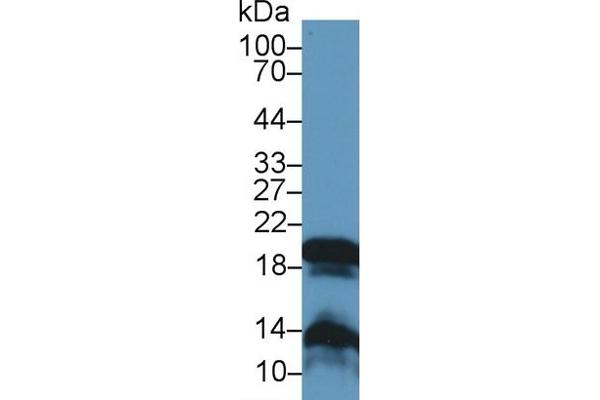 Gastrokine 2 Antikörper  (AA 21-184)